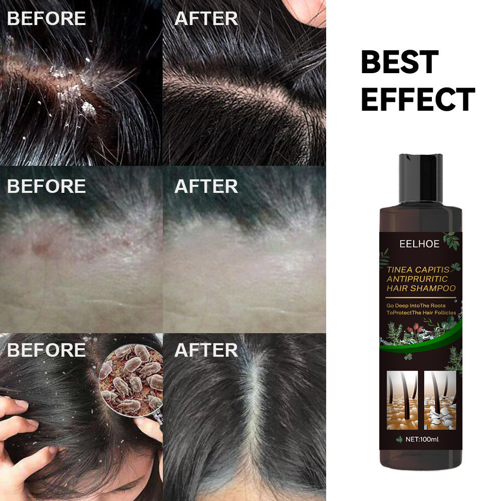 EELHOE Oil Control Anti-itching Shampoo Deep Cleaning